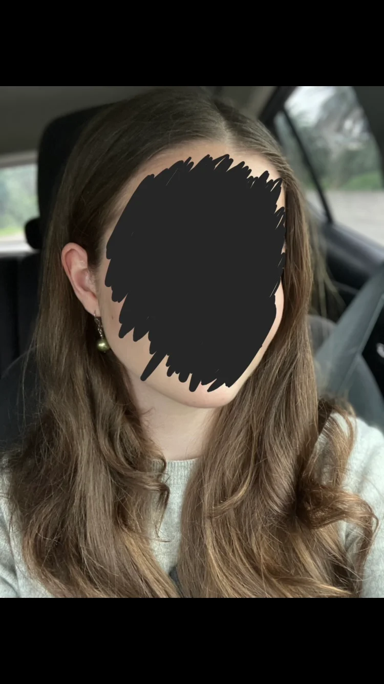 Image 1 of 1 attached to "Hair reveal"